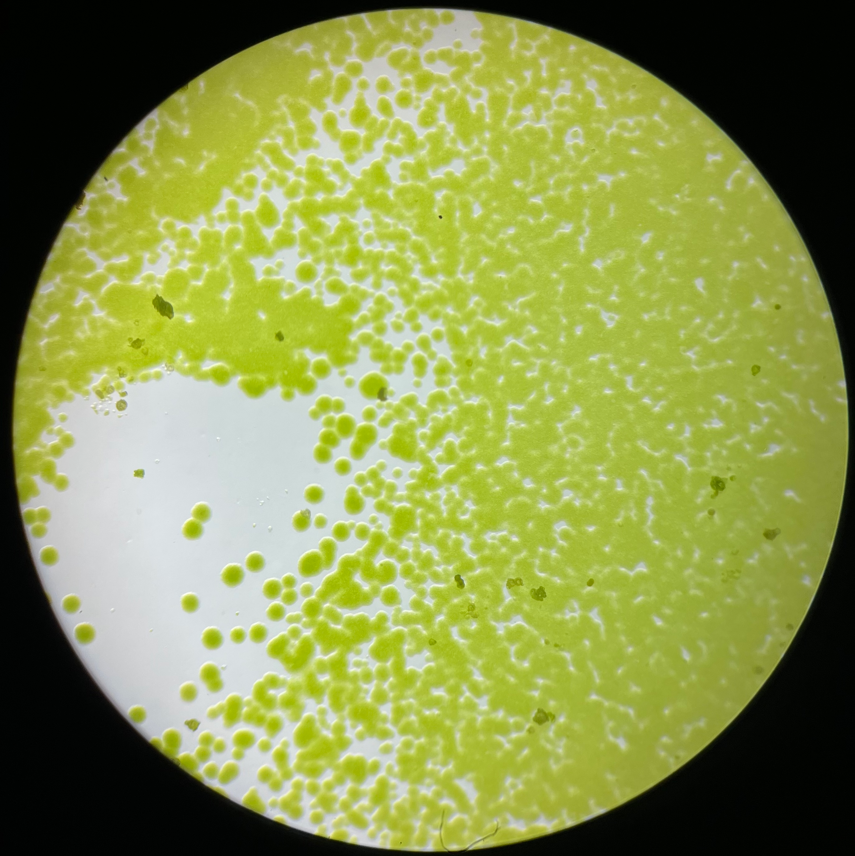 Chlorella: Microalga, superalimento